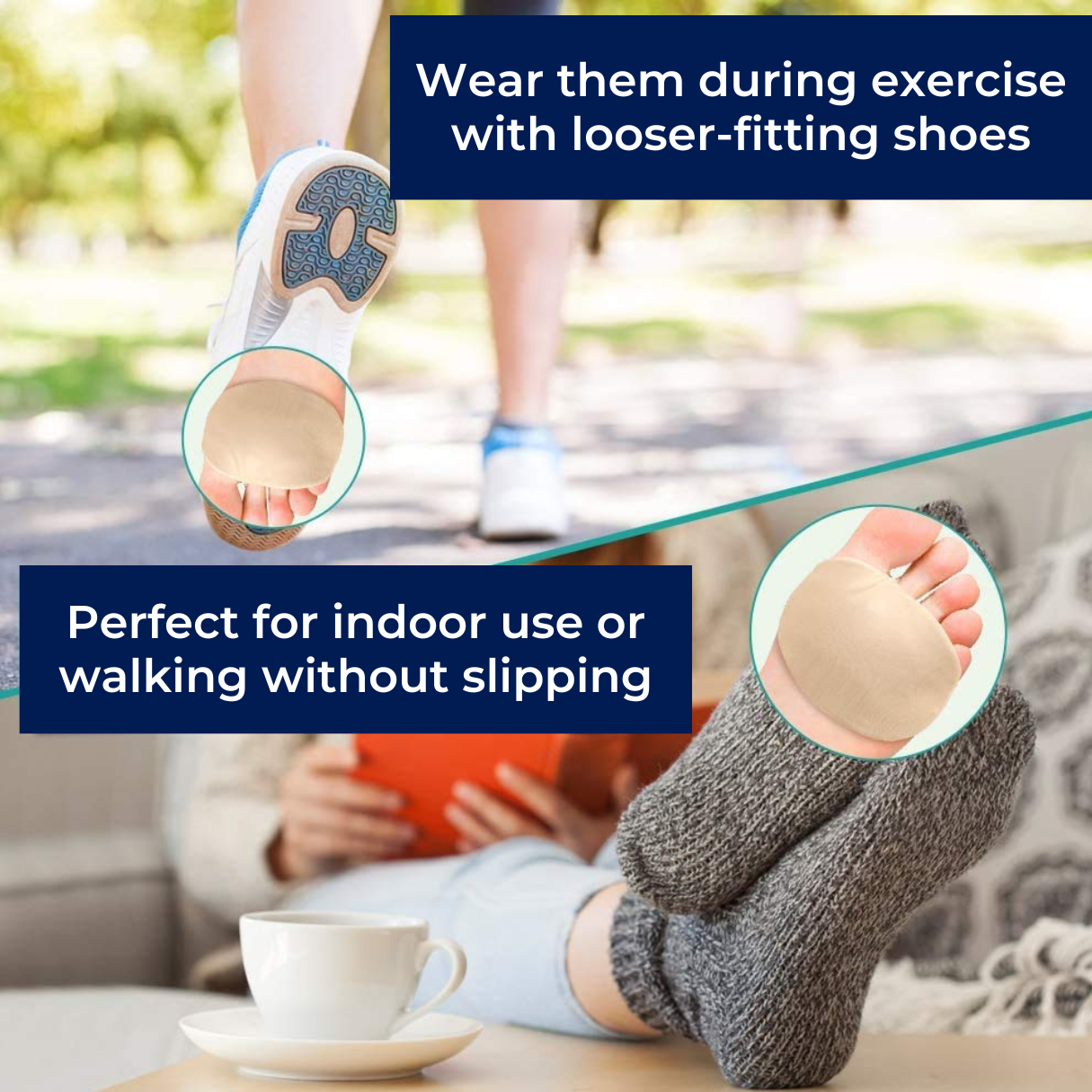 ComfortStep Morton’s Neuroma and Metatarsalgia Relief Pads | Gel Cushion and Metatarsal Support | Foot Pain Relief for Everyday Comfort Nokmo