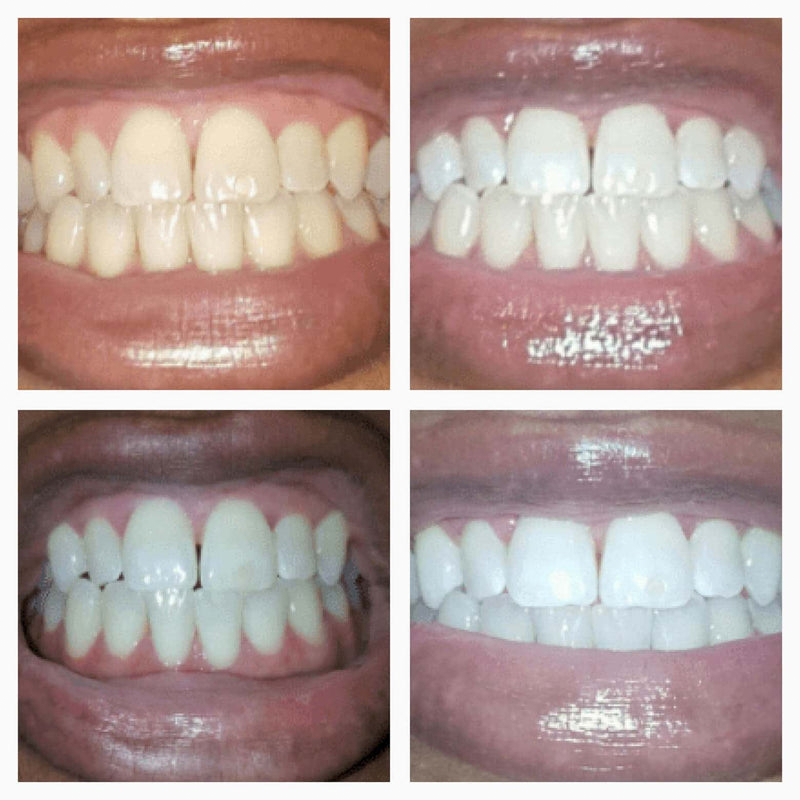GleamRush™ Serum — Ignite Unstoppable Confidence with a Brilliant, Stain-Free Smile