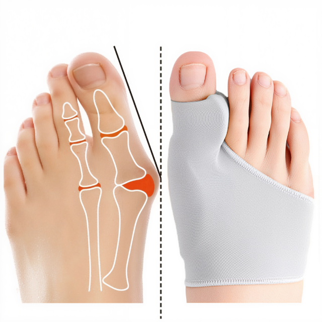 Nokmo | Gel Bunion Corrector for Foot Pain Relief
