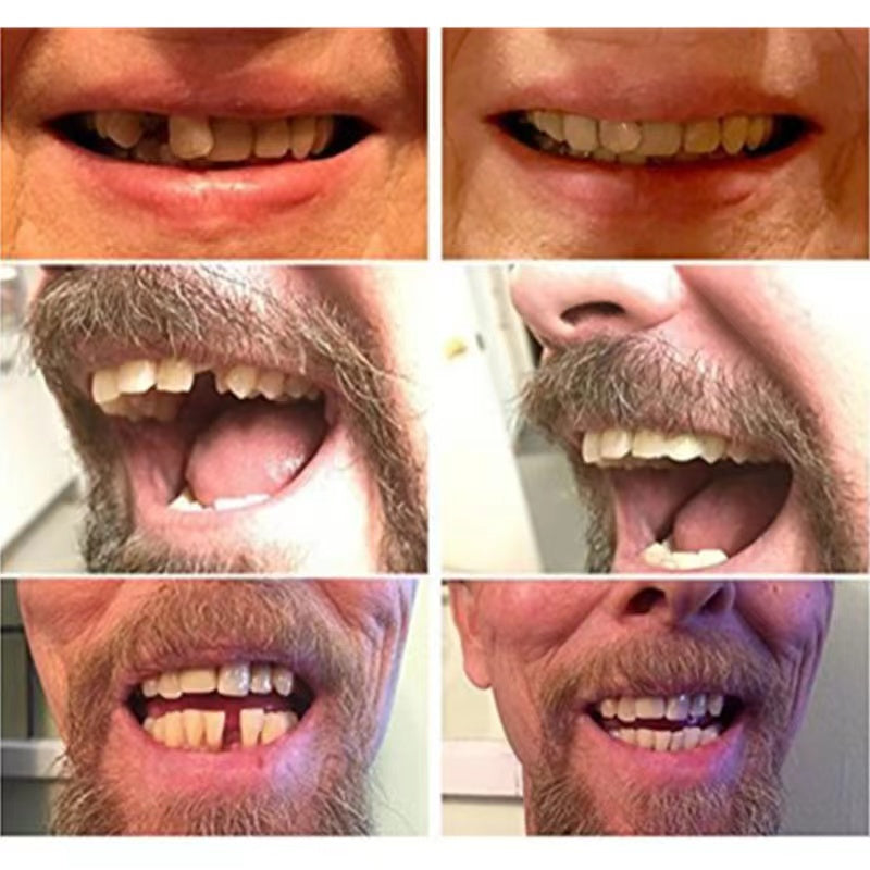 Nokmo | High-Quality False Teeth