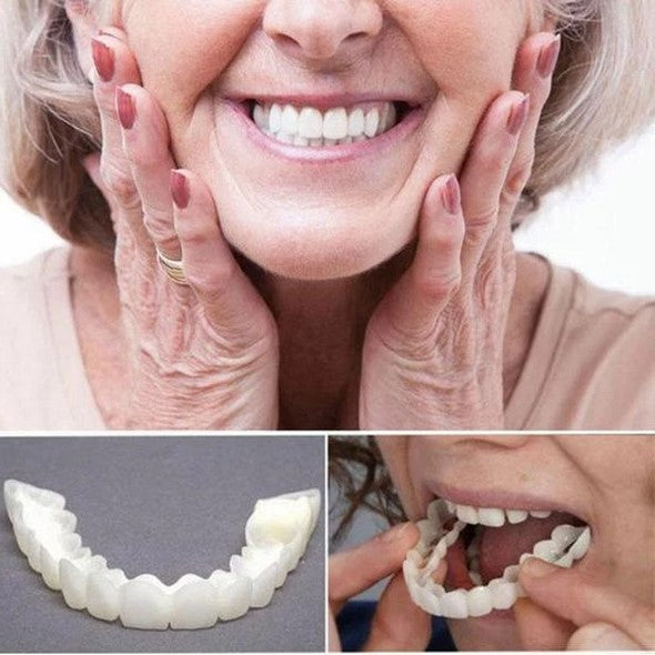 Nokmo | On Smile Veneers (Upper and Lower Jaw Included)
