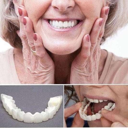 Nokmo | On Smile Veneers (Upper and Lower Jaw Included)