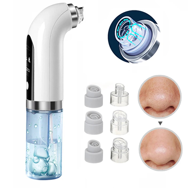 Nokmo | Professional Nose Blackhead Remover Vacuum - Deep Cleansing with Suction Technology