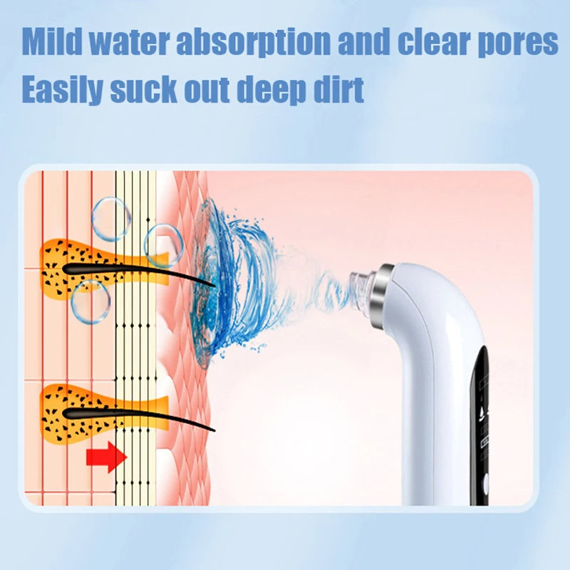 Nokmo | Professional Nose Blackhead Remover Vacuum - Deep Cleansing with Suction Technology