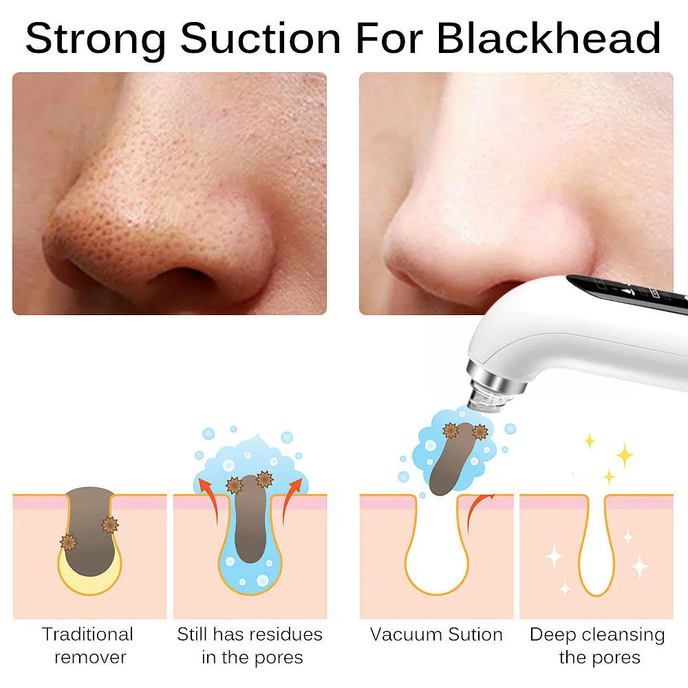 Nokmo | Professional Nose Blackhead Remover Vacuum - Deep Cleansing with Suction Technology