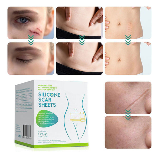Nokmo | Silicone Scar Tape Roll