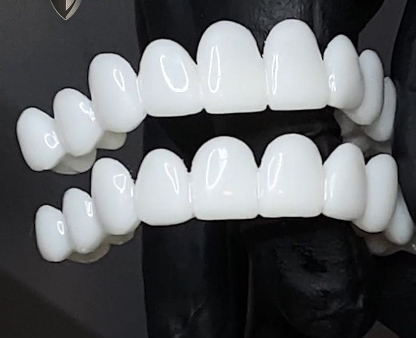 Nokmo | Snap-On Cosmetic Veneers | Instant Smile Cover for Imperfections