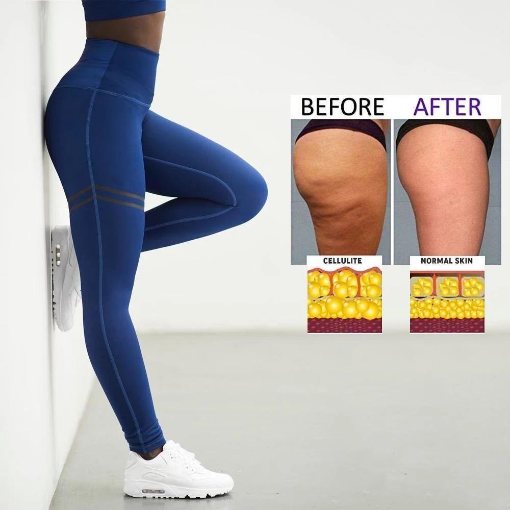 Nokmo | Women's Anti-Cellulite Compression Leggings